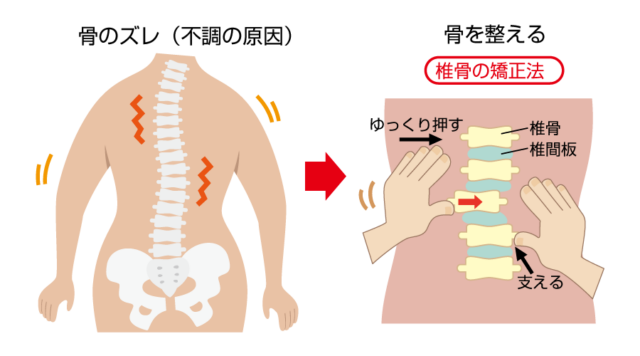 骨のズレ・背骨の矯正方法